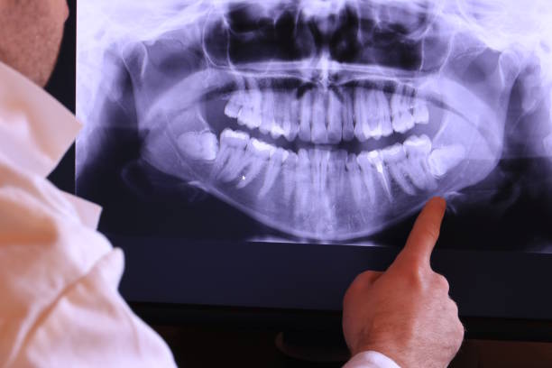 Best Emergency Dental Care for Broken or Chipped Teeth in Milan, TN